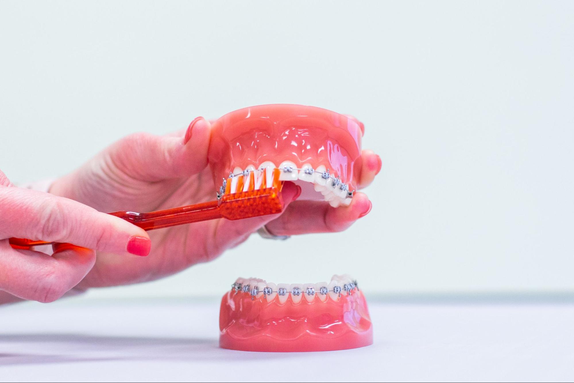 10 Tips For Brushing You Teeth With Braces