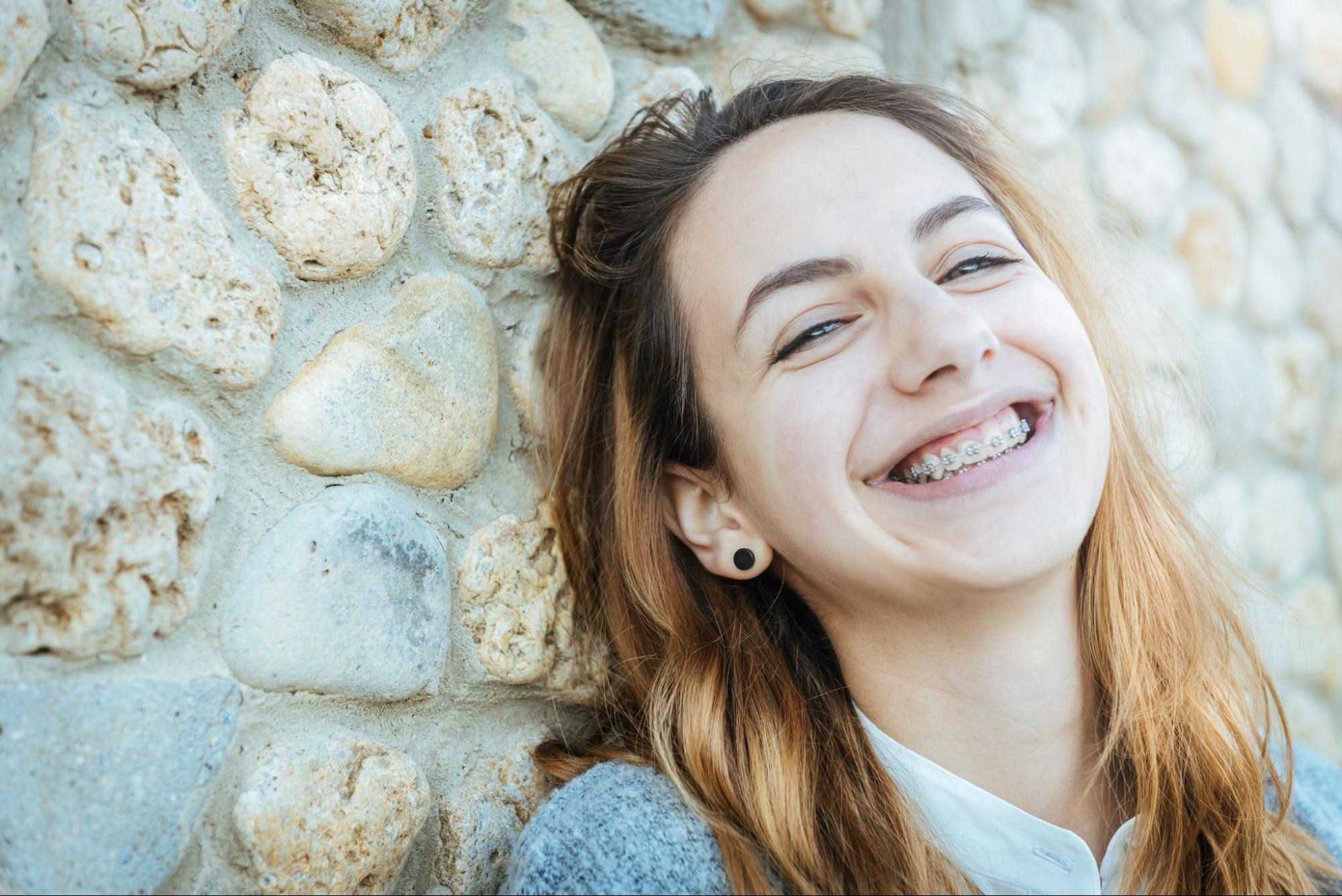 braces dothan